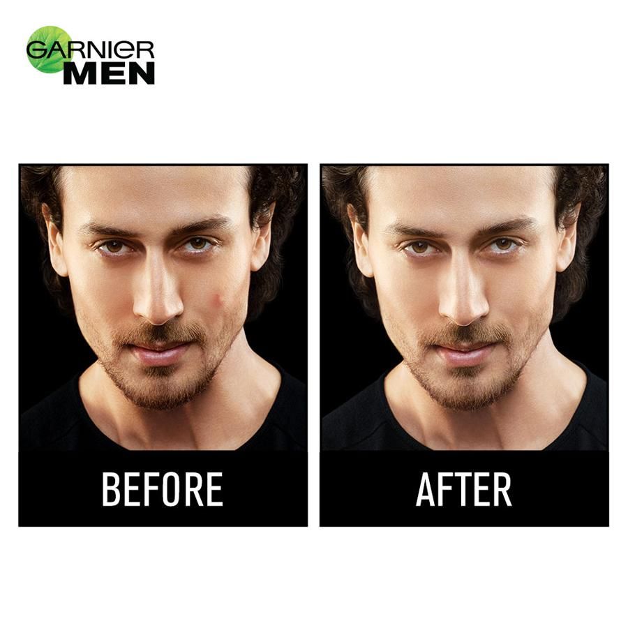 Garnier Men Acno Fight Pimple Clearing Whitening Day Cream